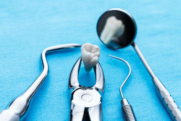 Surgical Tooth Extractions | Smile Design Center of Westchester